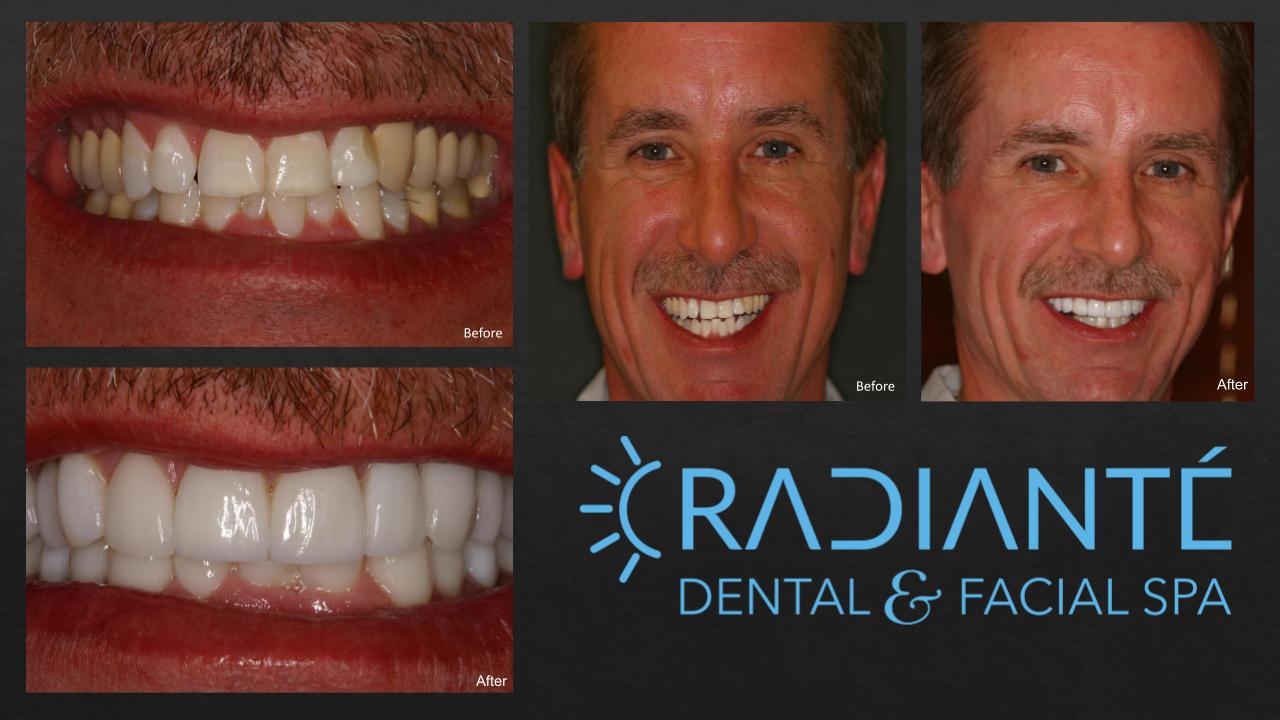 TV Slide Show in Progress.pptx (5)