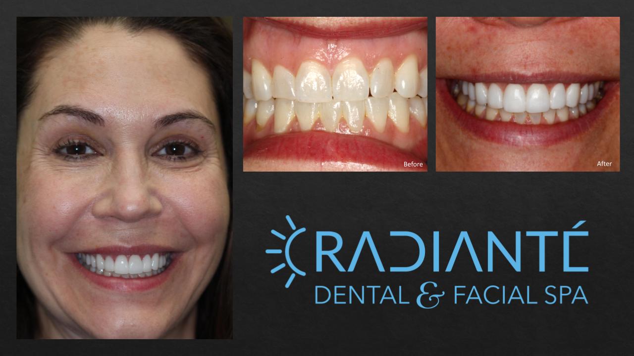 TV Slide Show in Progress.pptx