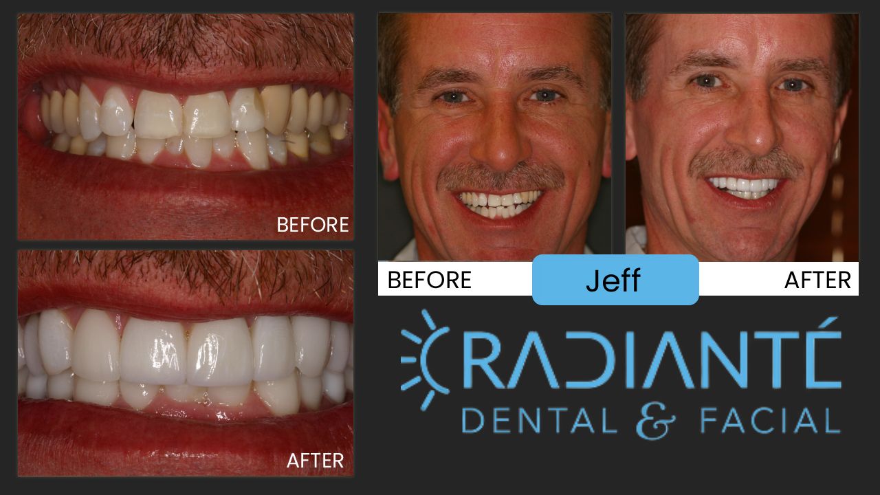Jeff's story is not unlike a lot of people having divorced and looking for something that will make you look and feel your best when entering the dating world again and there's nothing like a successful guy that looks the part with areally nice smile and younger looking whiter teeth!